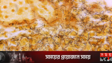 যুক্তরাষ্ট্রে ‘নিয়ন্ত্রণের বাইরে’ যৌনরোগ