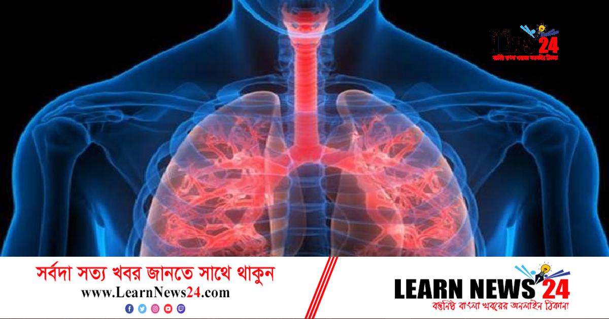 ফুসফুসের জন্য অমৃত ৪ চেনা ফল ফুসফুসের জন্য অমৃত ৪ চেনা ফল