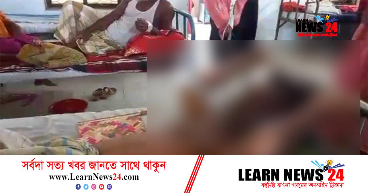 ঘুমন্ত স্বামীর শরীরে ফুটন্ত গরম পানি ঢেলে ঝলছে দিল স্ত্রী