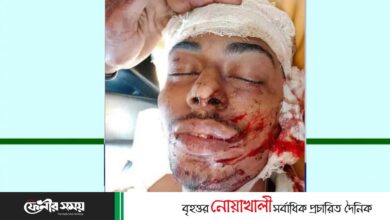 ফাজিলপুরে দুর্ঘটনায় আহত আরেক এসএসসি পরীক্ষার্থী মারা গেছে