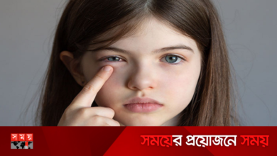 চোখ উঠলে অবশ্যই যা করবেন