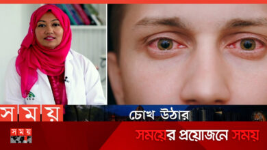 চোখ ওঠা সম্পর্কে অজানা যত তথ্য জানালেন চিকিৎসক!