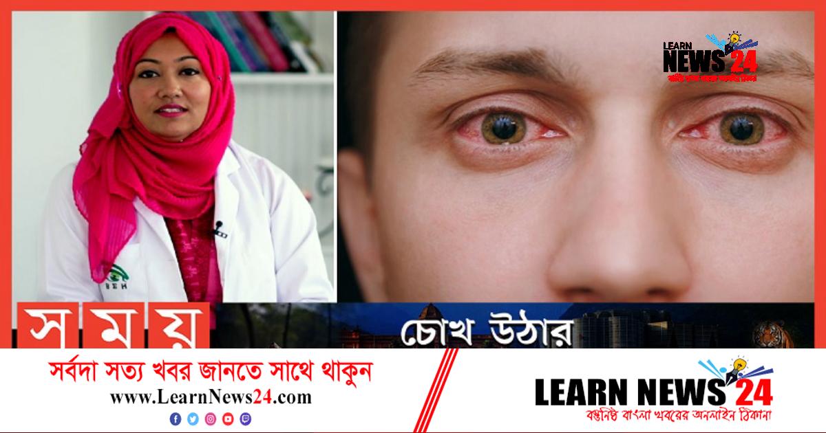চোখ ওঠা সম্পর্কে অজানা যত তথ্য জানালেন চিকিৎসক!