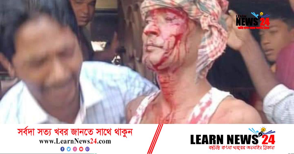 সোনাগাজীতে স্বর্ণ দোকান লুট : সেই অর্জুন ভাদুড়ীর মারা গেছেন