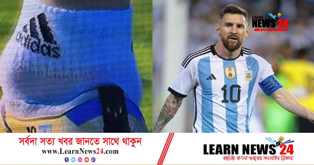 মারাত্মক চোট নিয়েই বিশ্বকাপ খেলতে নামছেন মেসি!