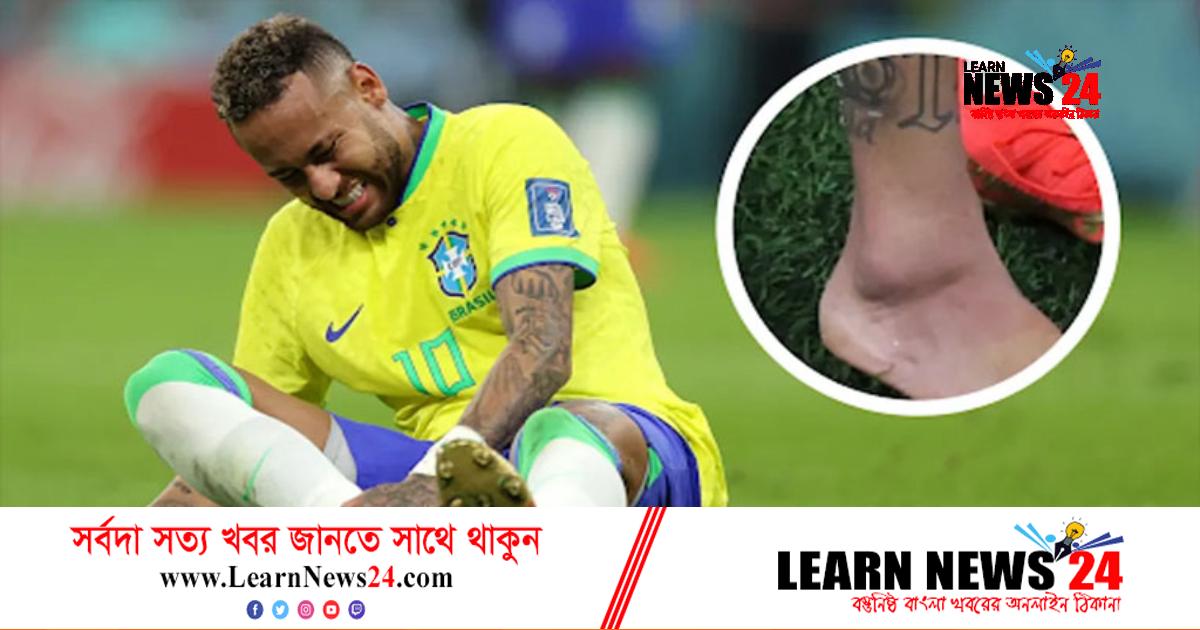 মারাত্মক ইনজুরিতে নেইমার, বিশ্বকাপ থেকে ছিটকে যাওয়ার শঙ্কা মারাত্মক ইনজুরিতে নেইমার, বিশ্বকাপ থেকে ছিটকে যাওয়ার শঙ্কা