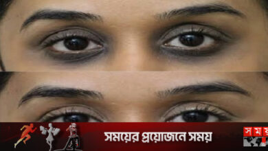 ডার্ক সার্কেলের জন্য ঘরোয়া উপায়