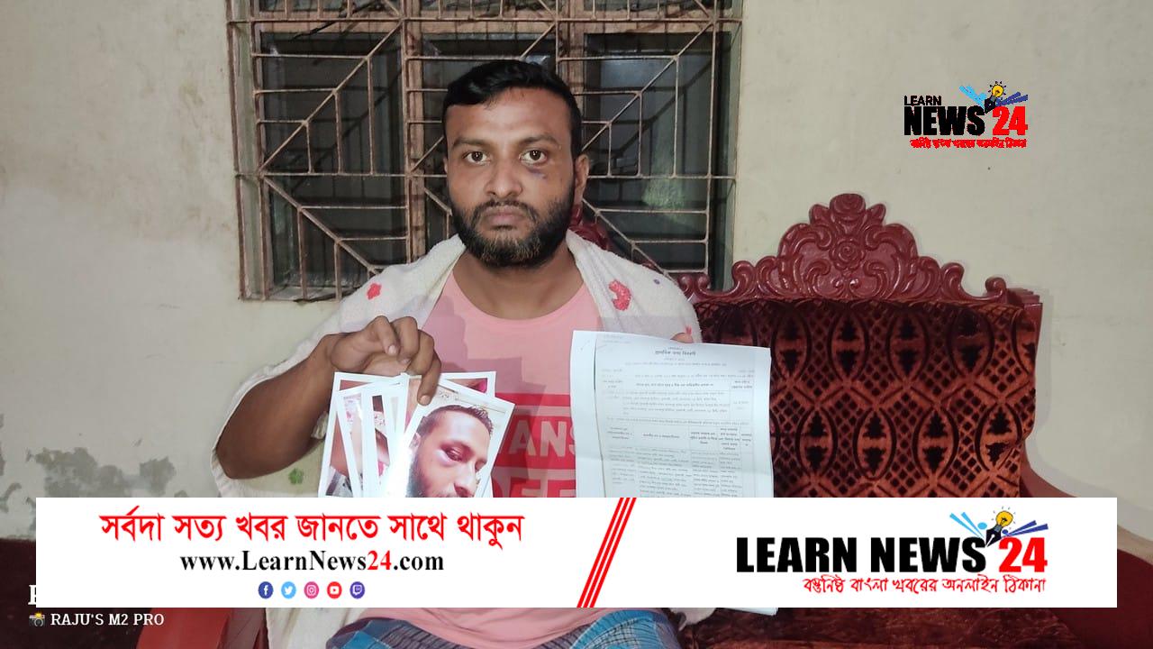 ফুলগাজীর আনন্দপুরে প্রবাসীকে পিটিয়ে পাসপোর্ট ও টাকা ছিনতাই, থানায় মামলা ফুলগাজীর আনন্দপুরে প্রবাসীকে পিটিয়ে পাসপোর্ট ও টাকা ছিনতাই, থানায় মামলা