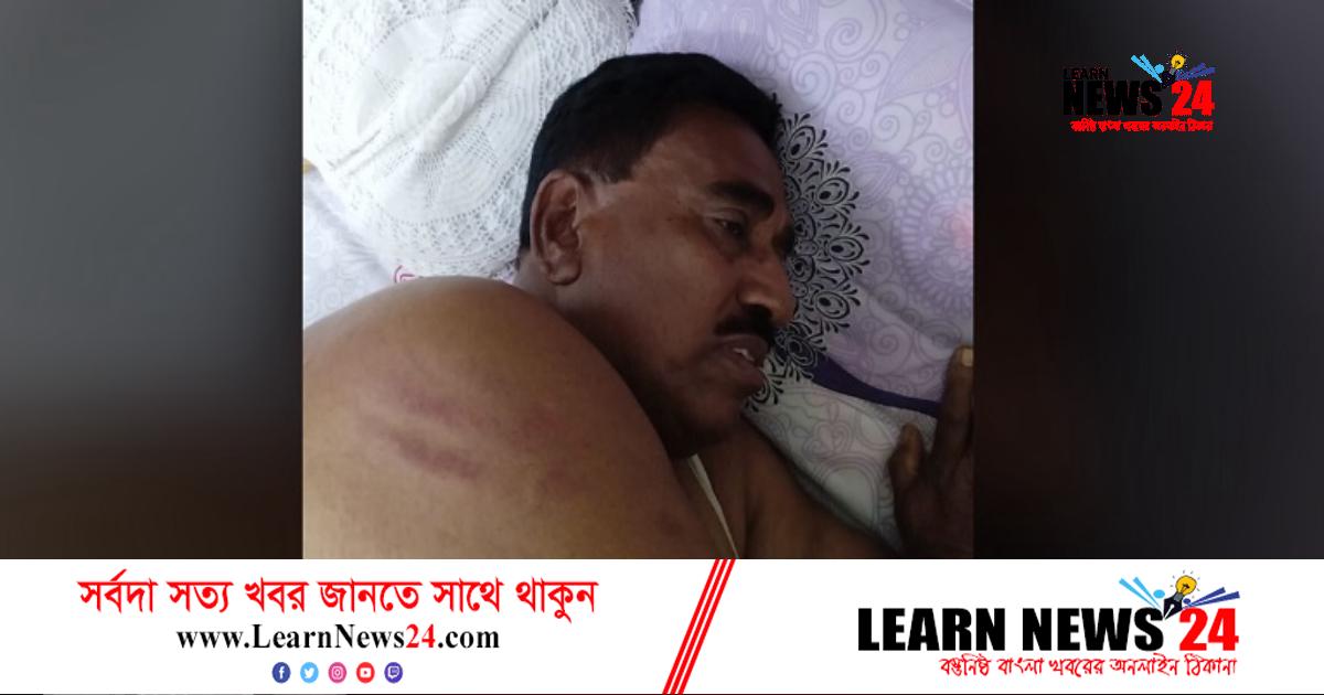 সমাবেশে যাওয়ার পথে বিএনপির সাবেক এমপির ওপর হামলা