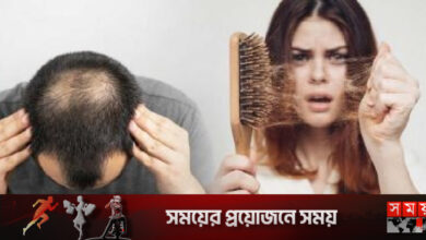 শীতে চার কারণেই চুল বেশি ঝরে