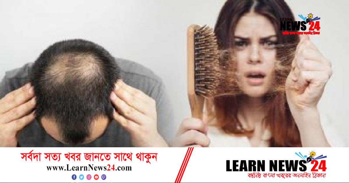 শীতে চার কারণেই চুল বেশি ঝরে শীতে চার কারণেই চুল বেশি ঝরে