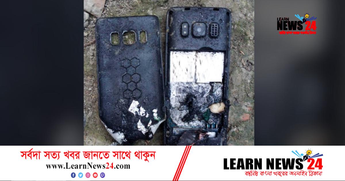 প্যান্টের পকেটে মোবাইল বিস্ফোরণ, কিশোর দগ্ধ