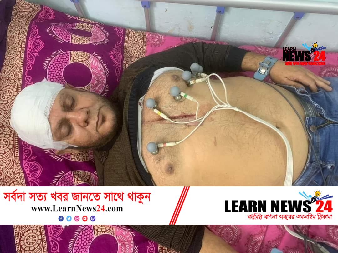 ফেনী পৌর বিএনপির আহবায়ক দেলোয়ার হোসেনকে কুপিয়েছে দুর্বৃত্তরা ফেনী পৌর বিএনপির আহবায়ক দেলোয়ার হোসেনকে কুপিয়েছে দুর্বৃত্তরা