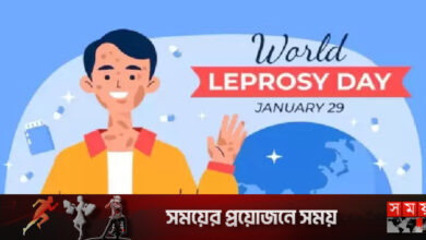 বিশ্ব কুষ্ঠ দিবস রোববার