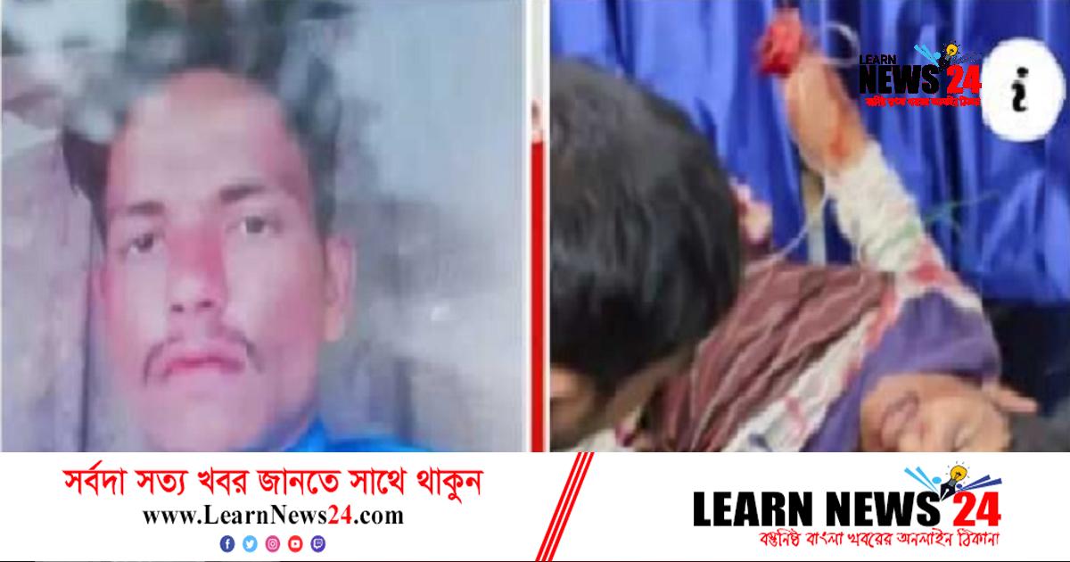 যাত্রী সেজে অটোরিক্সা চালকের কব্জি কেটে বিচ্ছিন্ন যাত্রী সেজে অটোরিক্সা চালকের কব্জি কেটে বিচ্ছিন্ন