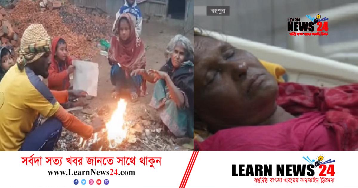 রংপুরে আগুন পোহাতে গিয়ে দগ্ধ ১০ রংপুরে আগুন পোহাতে গিয়ে দগ্ধ ১০