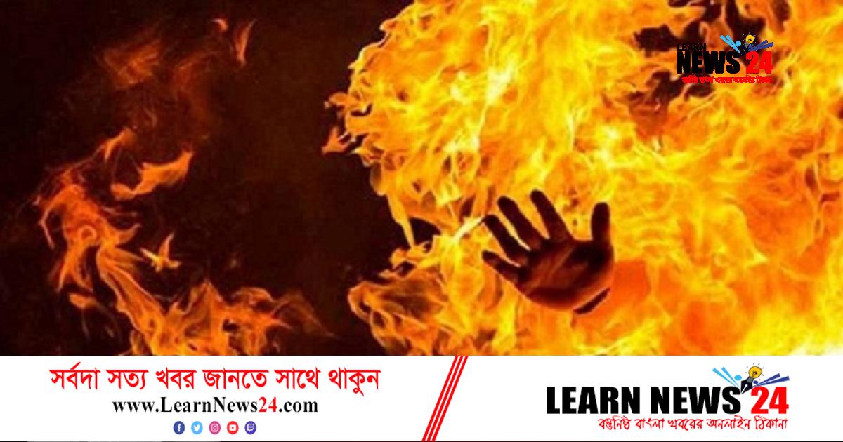 শরীরে কেরোসিন ঢেলে আগুনে পুড়িয়ে গৃহবধূকে হত্যা চেষ্টা শরীরে কেরোসিন ঢেলে আগুনে পুড়িয়ে গৃহবধূকে হত্যা চেষ্টা